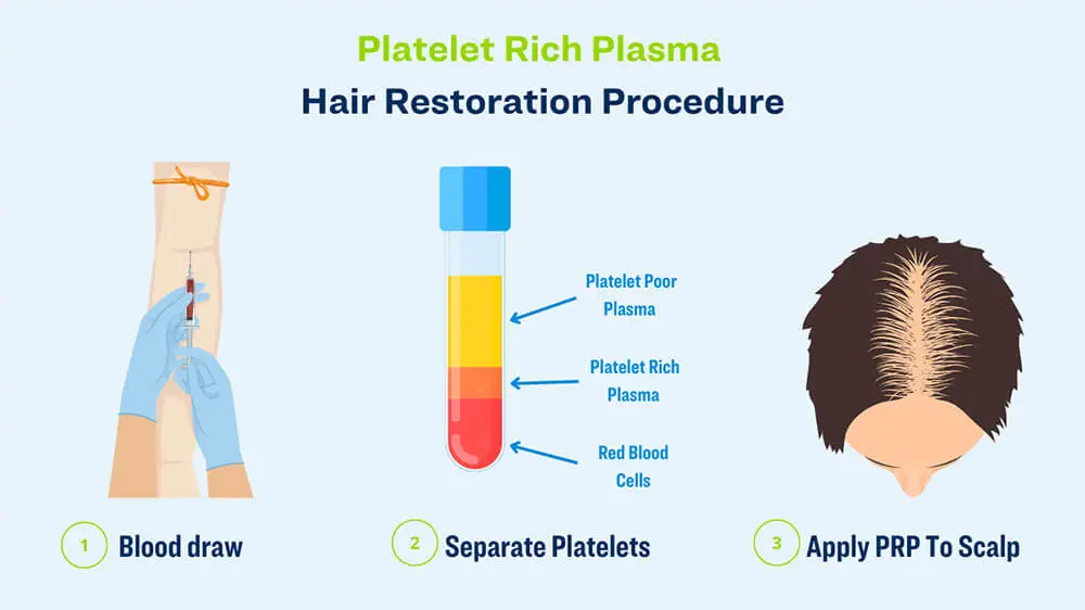 hair restoration procedure