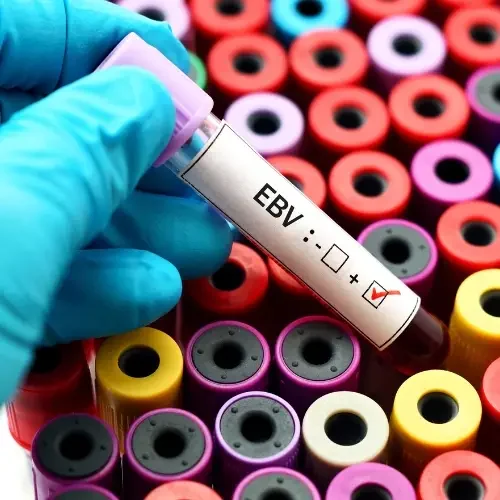 Reactivated-Epstein-Barr-Virus-Treatment Reactivated-Epstein-Barr-Virus-Treatment